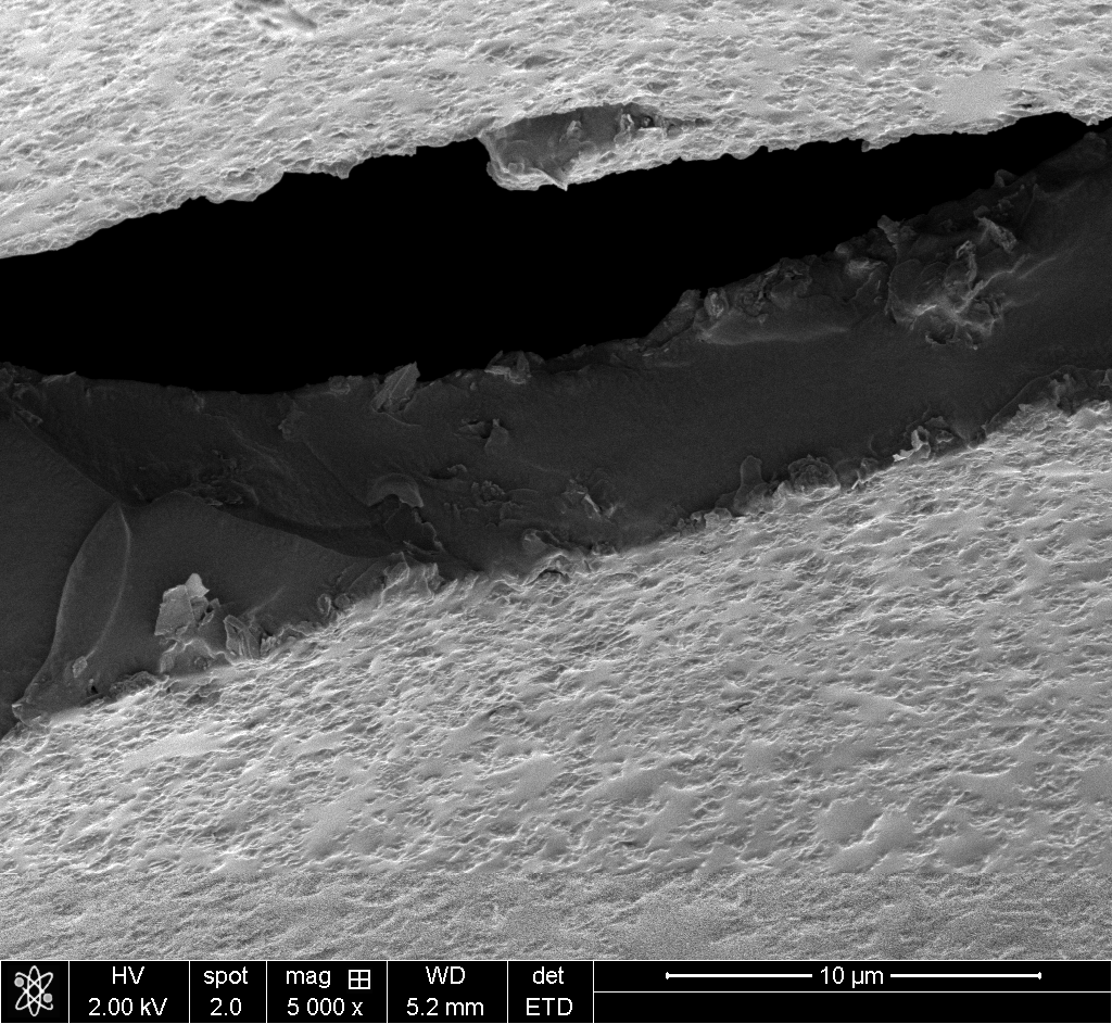SEM detail image